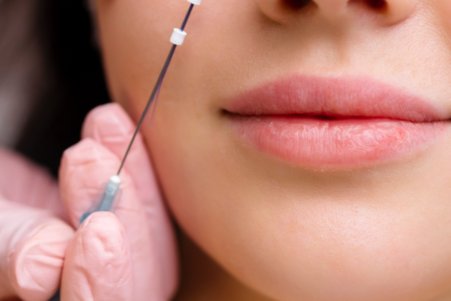 PDO Threads In York TImonium - skinaestheticsmedspa.com PDO Threads In York TImonium