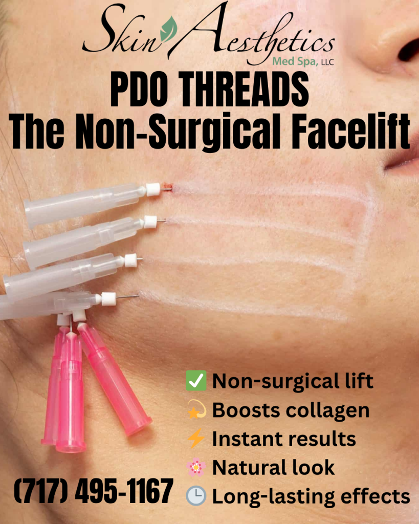 PDO THREADS The Non-Surgical Facelift