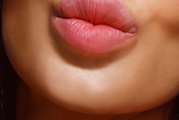 Lip Filler
